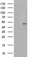 PHKG2 Antibody - HEK293T cells were transfected with the pCMV6-ENTRY control (Left lane) or pCMV6-ENTRY PHKG2 (Right lane) cDNA for 48 hrs and lysed. Equivalent amounts of cell lysates (5 ug per lane) were separated by SDS-PAGE and immunoblotted with anti-PHKG2.