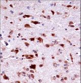 PHKG2 Antibody - Mouse Phkg2 Antibody immunohistochemistry of formalin-fixed and paraffin-embedded mouse brain tissue followed by peroxidase-conjugated secondary antibody and DAB staining.