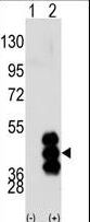 PHKG2 Antibody - Western blot of PHKG2 (arrow) using PHKG2 Antibody. 293 cell lysates (2 ug/lane) either nontransfected (Lane 1) or transiently transfected with the PHKG2 gene (Lane 2) (Origene Technologies).