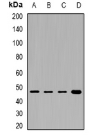 PHKG2 Antibody - Western blot analysis of PHKG2 expression in HepG2 (A); Jurkat (B); mouse brain (C); rat liver (D) whole cell lysates.