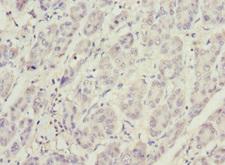 PHKG2 Antibody - Immunohistochemistry of paraffin-embedded human liver tissue at dilution 1:100