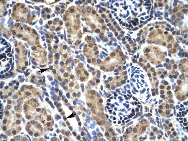 PHKG2 Antibody - Human Kidney.  This image was taken for the unconjugated form of this product. Other forms have not been tested.