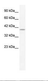 PHKG2 Antibody - HepG2 Cell Lysate.  This image was taken for the unconjugated form of this product. Other forms have not been tested.