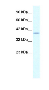 PHKG2 Antibody - PHKG2 antibody Western blot of HepG2 cell lysate. This image was taken for the unconjugated form of this product. Other forms have not been tested.