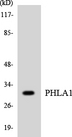 PHLDA1 Antibody - Western blot analysis of the lysates from K562 cells using PHLA1 antibody.