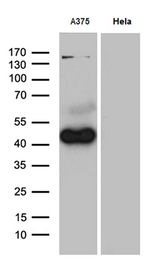 PHLDA1 Antibody - Western blot analysis of extracts. (35ug) from 2 different cell lines by using anti-PHLDA1 monoclonal antibody. (1:500)