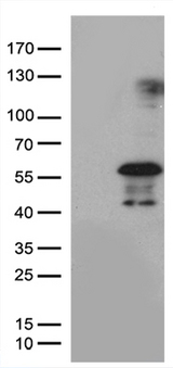 PHLDA1 Antibody - HEK293T cells were transfected with the pCMV6-ENTRY control. (Left lane) or pCMV6-ENTRY PHLDA1. (Right lane) cDNA for 48 hrs and lysed