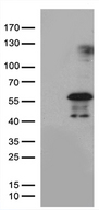 PHLDA1 Antibody - HEK293T cells were transfected with the pCMV6-ENTRY control. (Left lane) or pCMV6-ENTRY PHLDA1. (Right lane) cDNA for 48 hrs and lysed