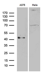 PHLDA1 Antibody - Western blot analysis of extracts. (35ug) from 2 cell lines by using anti-PHLDA1 monoclonal antibody. (1:500)