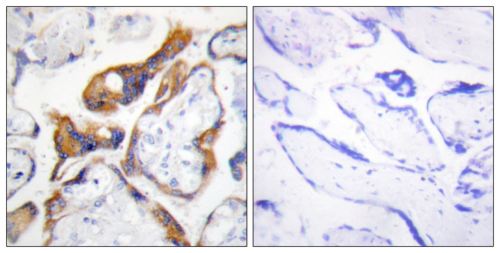 PHLDA2 / TSSC3 Antibody - Immunohistochemistry analysis of paraffin-embedded human placenta, using PHLA2 Antibody. The picture on the right is blocked with the synthesized peptide.
