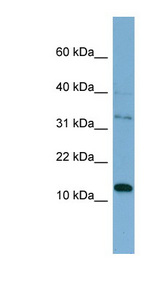 PHLDA2 / TSSC3 Antibody - PHLDA2 antibody Western blot of HT1080 cell lysate. This image was taken for the unconjugated form of this product. Other forms have not been tested.