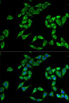 PHLDA2 / TSSC3 Antibody - Immunofluorescence analysis of HeLa cell using PHLDA2 antibody. Blue: DAPI for nuclear staining.