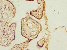 PHLDA2 / TSSC3 Antibody - Immunohistochemistry of paraffin-embedded human placenta tissue at dilution 1:100