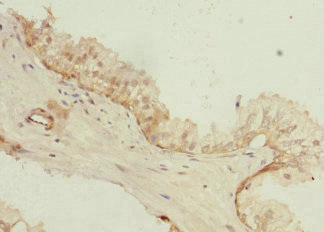 PHLDA2 / TSSC3 Antibody - Immunohistochemistry of paraffin-embedded human prostate tissue at dilution 1:100
