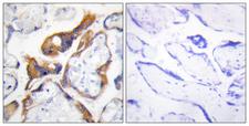PHLDA2 / TSSC3 Antibody - Peptide - + Immunohistochemistry analysis of paraffin-embedded human placenta tissue, using PHLA2 antibody.
