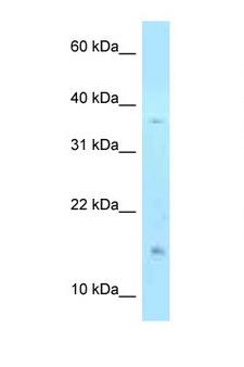 PHLDA2 / TSSC3 Antibody - PHLDA2 antibody Western blot of 293T Cell lysate. Antibody concentration 1 ug/ml.  This image was taken for the unconjugated form of this product. Other forms have not been tested.