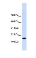PHLDA3 Antibody - 293T cell lysate. Antibody concentration: 1.0 ug/ml. Gel concentration: 10-20%.  This image was taken for the unconjugated form of this product. Other forms have not been tested.