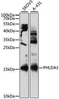 PHLDA3 Antibody - Western blot analysis of extracts of various cell lines, using PHLDA3 antibody at 1:3000 dilution. The secondary antibody used was an HRP Goat Anti-Rabbit IgG (H+L) at 1:10000 dilution. Lysates were loaded 25ug per lane and 3% nonfat dry milk in TBST was used for blocking. An ECL Kit was used for detection and the exposure time was 30min.