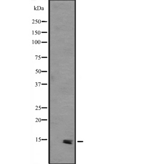 PHLDA3 Antibody - Western blot analysis of PHLDA3 expression in HEK293 cells. The lane on the left is treated with the antigen-specific peptide.