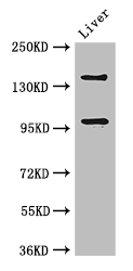 PHLDB2 Antibody - Positive WB detected in:Mouse liver tissue;All lanes: PHLDB2 antibody at 3ug/ml;Secondary;Goat polyclonal to rabbit IgG at 1/50000 dilution;Predicted band size: 143,137,140 kDa;Observed band size: 143,96 kDa;