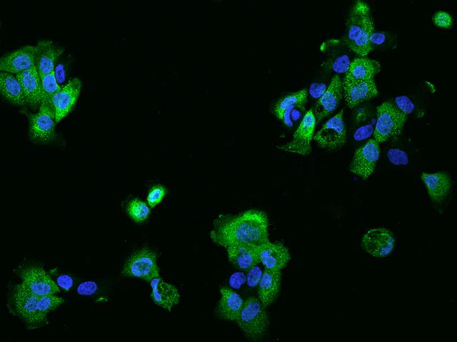 PHLDB2 Antibody - Immunofluorescence staining of PHLDB2 in A431 cells. Cells were fixed with 4% PFA, permeabilzed with 0.1% Triton X-100 in PBS, blocked with 10% serum, and incubated with rabbit anti-Human PHLDB2 polyclonal antibody (dilution ratio 1:200) at 4°C overnight. Then cells were stained with the Alexa Fluor 488-conjugated Goat Anti-rabbit IgG secondary antibody (green) and counterstained with DAPI (blue). Positive staining was localized to Cytoplasm and cell membrane.