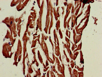 PHOSPHO1 Antibody - Immunohistochemistry of paraffin-embedded human heart tissue at dilution of 1:100