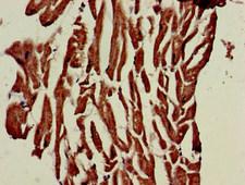 PHOSPHO1 Antibody - Immunohistochemistry of paraffin-embedded human heart tissue at dilution of 1:100