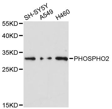 PHOSPHO2 Antibody - Western blot analysis of extracts of various cell lines, using PHOSPHO2 antibody at 1:3000 dilution. The secondary antibody used was an HRP Goat Anti-Rabbit IgG (H+L) at 1:10000 dilution. Lysates were loaded 25ug per lane and 3% nonfat dry milk in TBST was used for blocking. An ECL Kit was used for detection and the exposure time was 90s.