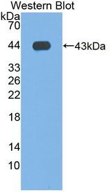 Phospholipase D Antibody - Western blot of Phospholipase D antibody.