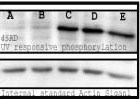 Phosphoserine Antibody - Western blot analysis of the phosphorylated proteins with UV-treated cell lysates mouse spleen cell. Bands are responsive to treatment with varying long UV wavelengths: A(0), B(50), C(200), D(400), and E (treated with 0.1 uM okadaic acid).