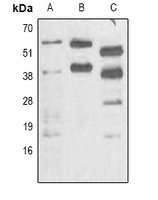 Phosphoserine Antibody - Western blot analysis of Phosphoserine expression in Jurkat (A); mouse brain (B); rat brain (C) whole cell lysates.