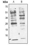 Phosphotyrosine Antibody - Western blot analysis of Phosphotyrosine expression in Jurkat (A); 293T (B) whole cell lysates.
