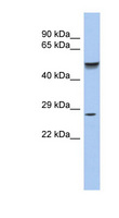 PHOX2A Antibody - PHOX2A antibody Western blot of Fetal Stomach lysate. This image was taken for the unconjugated form of this product. Other forms have not been tested.