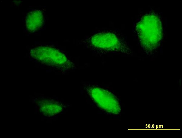PHOX2A Antibody - Immunofluorescence of monoclonal antibody to PHOX2A on HeLa cell. [antibody concentration 10 ug/ml]