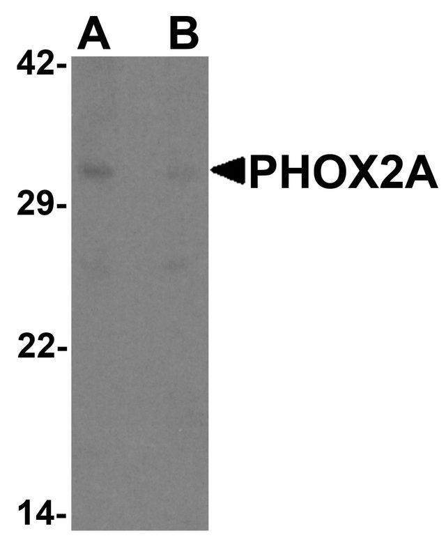 PHOX2A Antibody - Western blot analysis of PHOX2A in rat brain tissue lysate with PHOX2A antibody at 1 ug/ml in (A) the absence and (B) the presence of blocking peptide.