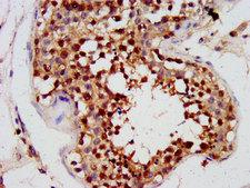 PHOX2A Antibody - Immunohistochemistry image at a dilution of 1:300 and staining in paraffin-embedded human testis tissue performed on a Leica BondTM system.