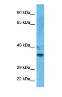 PHOX2B Antibody - Western blot of PHX2B Antibody with human 721_B Whole Cell lysate.  This image was taken for the unconjugated form of this product. Other forms have not been tested.