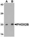 PHOX2B Antibody - Western blot analysis of PHOX2B in 293 cell lysate with PHOX2B antibody at (A) 1 and (B) 2 ug/ml.