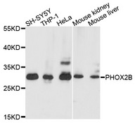 PHOX2B Antibody - Western blot analysis of extracts of various cells.
