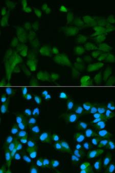 PHPT1 Antibody - Immunofluorescence analysis of HeLa cells.
