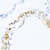 PHPT1 Antibody - Immunohistochemistry of formalin-fixed paraffin-embedded (FFPE) rat lung using PHPT1 antibody at dilution of 1:100 (40x magnification).