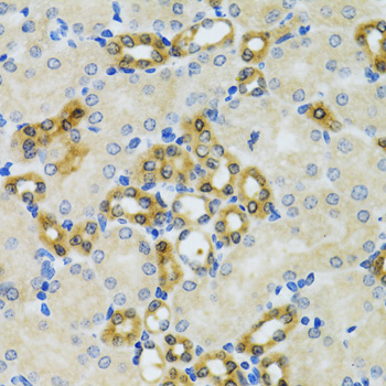 PHPT1 Antibody - Immunohistochemistry of paraffin-embedded mouse kidney using PHPT1 antibodyat dilution of 1:100 (40x lens).