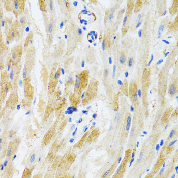 PHPT1 Antibody - Immunohistochemistry of paraffin-embedded mouse heart using PHPT1 antibodyat dilution of 1:100 (40x lens).