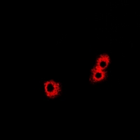 PHPT1 Antibody - Immunofluorescent analysis of PHPT1 staining in HeLa cells. Formalin-fixed cells were permeabilized with 0.1% Triton X-100 in TBS for 5-10 minutes and blocked with 3% BSA-PBS for 30 minutes at room temperature. Cells were probed with the primary antibody in 3% BSA-PBS and incubated overnight at 4 deg C in a humidified chamber. Cells were washed with PBST and incubated with a DyLight 594-conjugated secondary antibody (red) in PBS at room temperature in the dark.