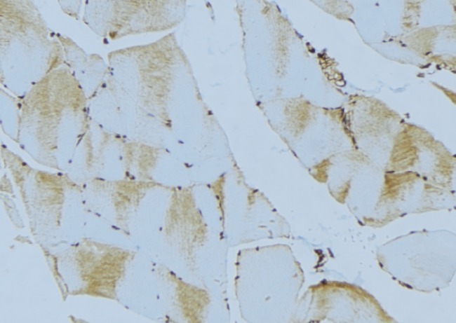 PHPT1 Antibody - 1:100 staining mouse muscle tissue by IHC-P. The sample was formaldehyde fixed and a heat mediated antigen retrieval step in citrate buffer was performed. The sample was then blocked and incubated with the antibody for 1.5 hours at 22°C. An HRP conjugated goat anti-rabbit antibody was used as the secondary.