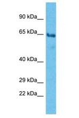PHTF2 Antibody - PHTF2 antibody Western Blot of Thyroid tumor. Antibody dilution: 1 ug/ml.  This image was taken for the unconjugated form of this product. Other forms have not been tested.