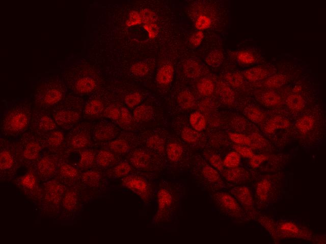 PHTF2 Antibody - Immunofluorescence staining of PHTF2 in A431 cells. Cells were fixed with 4% PFA, permeabilzed with 0.1% Triton X-100 in PBS, blocked with 10% serum, and incubated with rabbit anti-Human PHTF2 polyclonal antibody (dilution ratio 1:200) at 4°C overnight. Then cells were stained with the Alexa Fluor 594-conjugated Goat Anti-rabbit IgG secondary antibody (red). Positive staining was localized to Nucleus and cytoplasm.