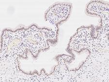 PHTF2 Antibody - Immunochemical staining of human PHTF2 in human gallbladder with rabbit polyclonal antibody at 1:200 dilution, formalin-fixed paraffin embedded sections.