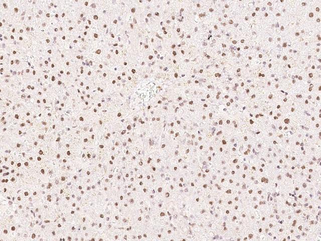 PHTF2 Antibody - Immunochemical staining of human PHTF2 in human liver with rabbit polyclonal antibody at 1:200 dilution, formalin-fixed paraffin embedded sections.