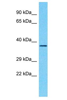 PHYHD1 Antibody - PHYHD1 antibody Western Blot of HCT15. Antibody dilution: 1 ug/ml.  This image was taken for the unconjugated form of this product. Other forms have not been tested.